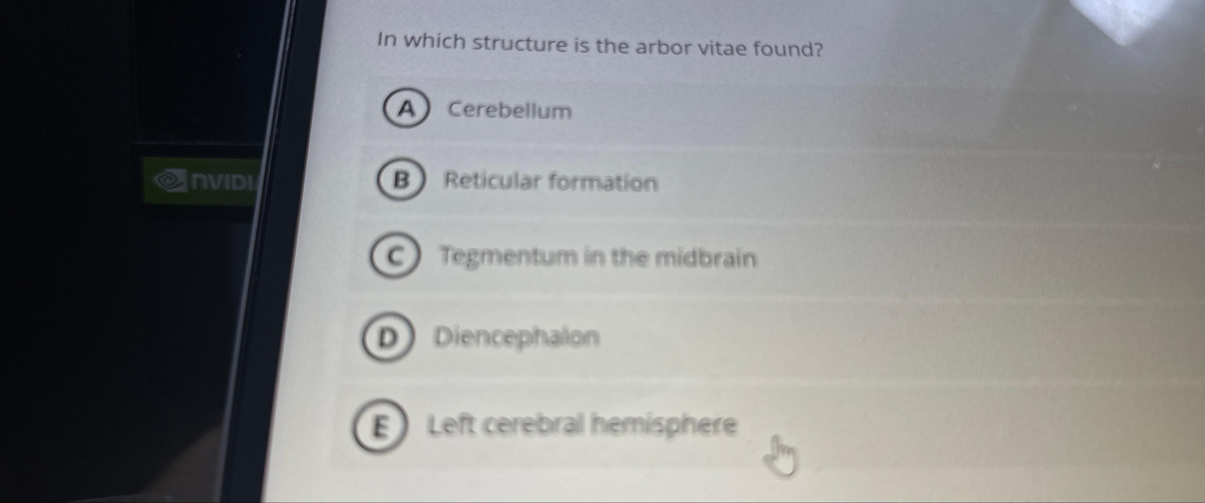 Solved In which structure is the arbor vitae