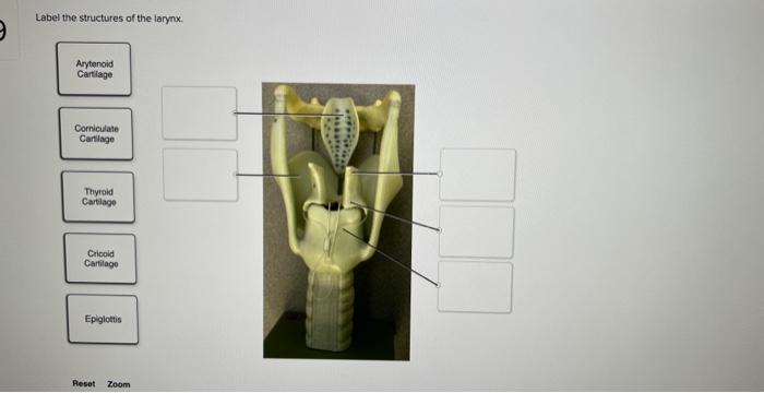 Label the structures of the larynx.