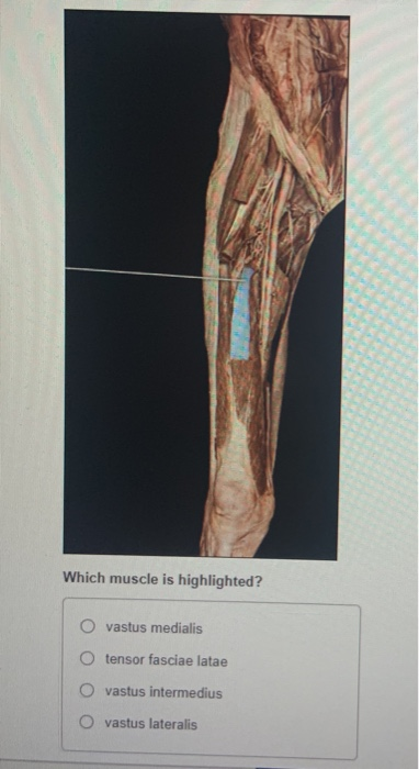 Solved Which muscle is highlighted? vastus medialis O tensor | Chegg.com