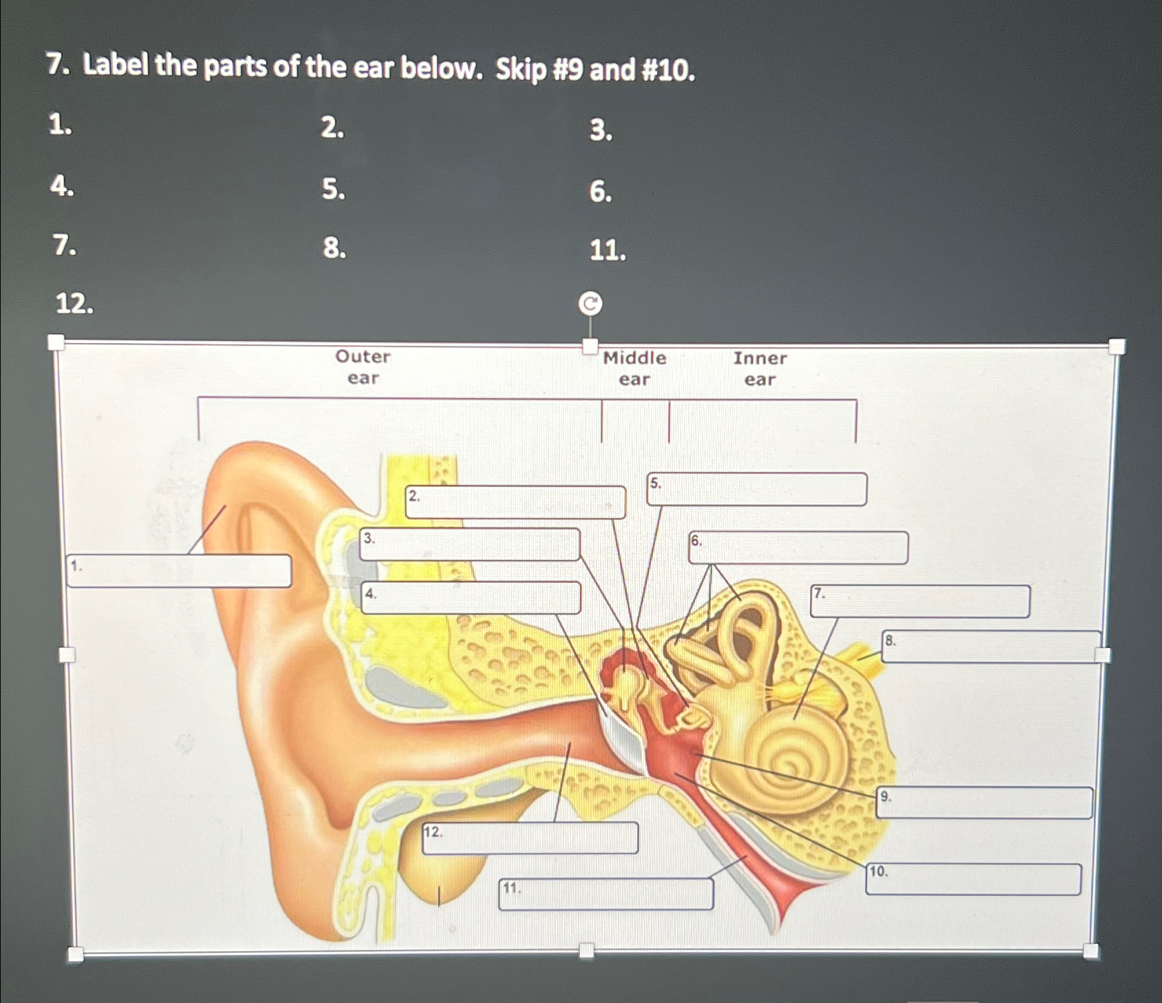 Solved Label the parts of the ear below. Skip #9 ﻿and #10. | Chegg.com