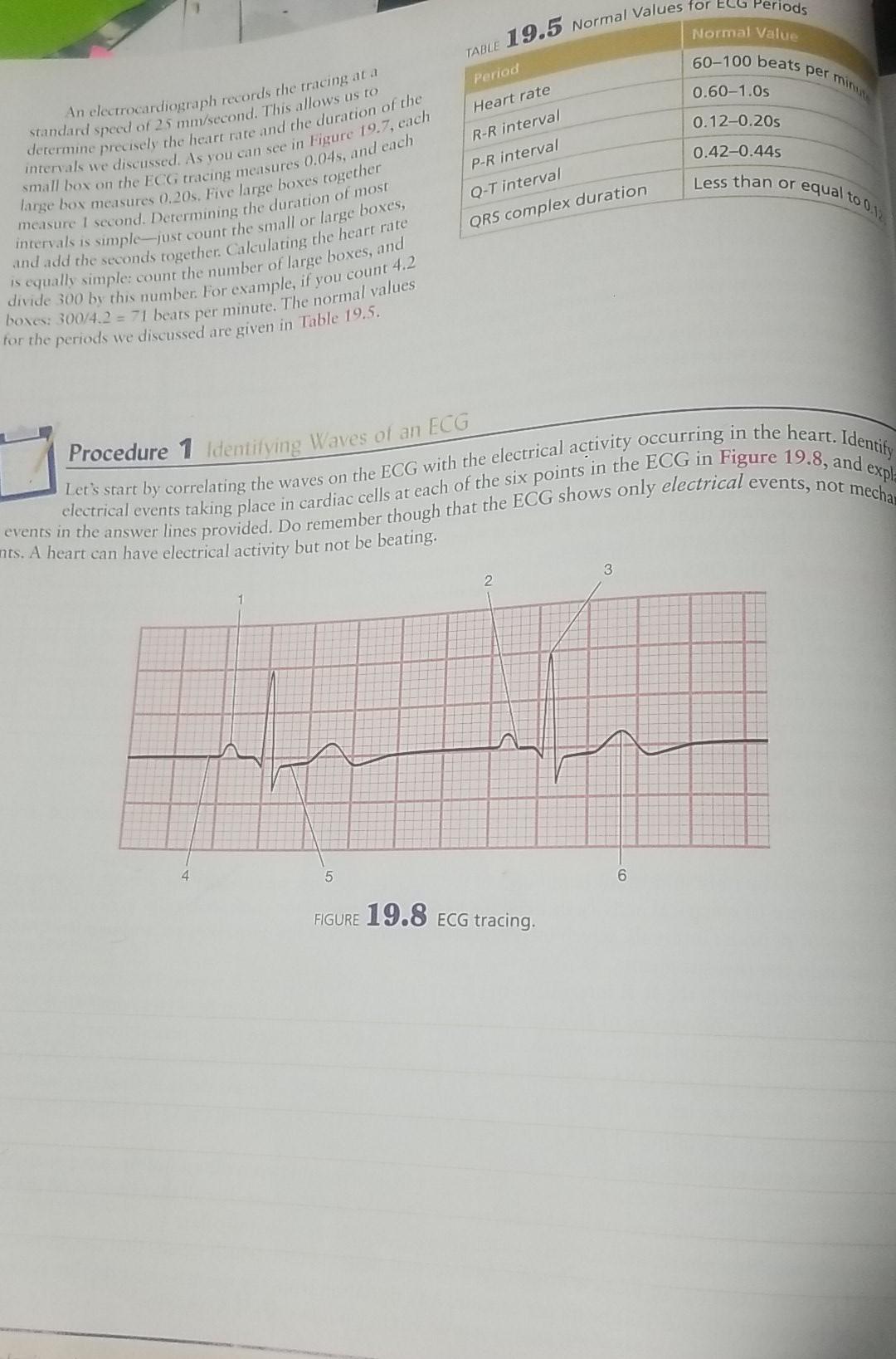 Solved TABLE 19.5 Normal Values for ECG Periods Normal Value | Chegg.com