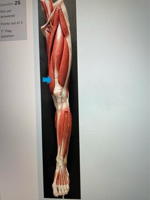 Solved Select one: a. rectus femoris b. vastus lateralis c. | Chegg.com