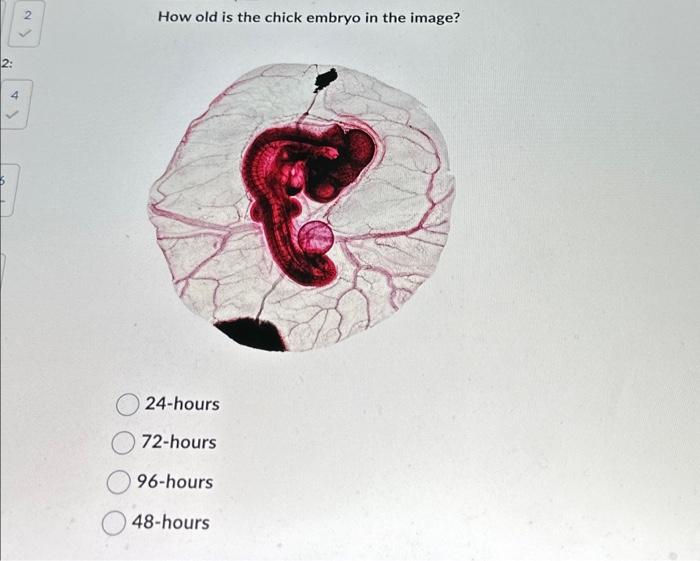 Solved 2: 6 4 2 How old is the chick embryo in the image? | Chegg.com