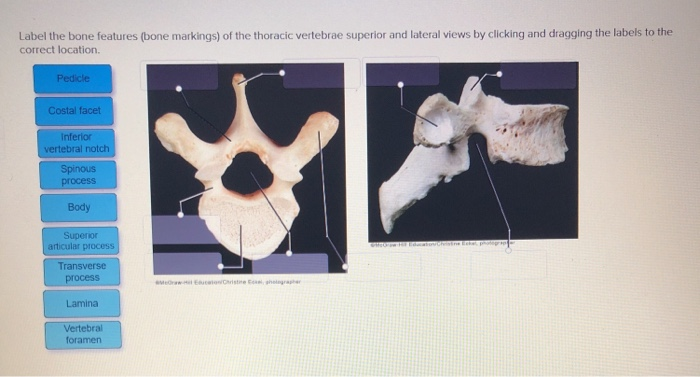 Solved Label the bone features (bone markings) of the | Chegg.com