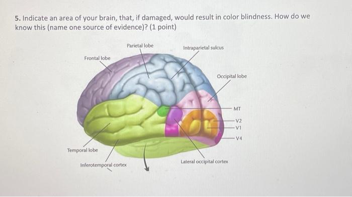 Solved 5. Indicate an area of your brain, that, if damaged, | Chegg.com