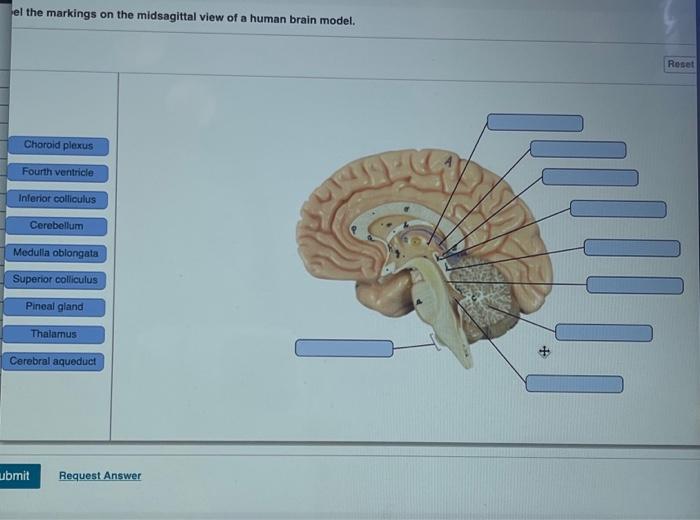 Solved El The Markings On The Midsagittal View Of A Human | Chegg.com