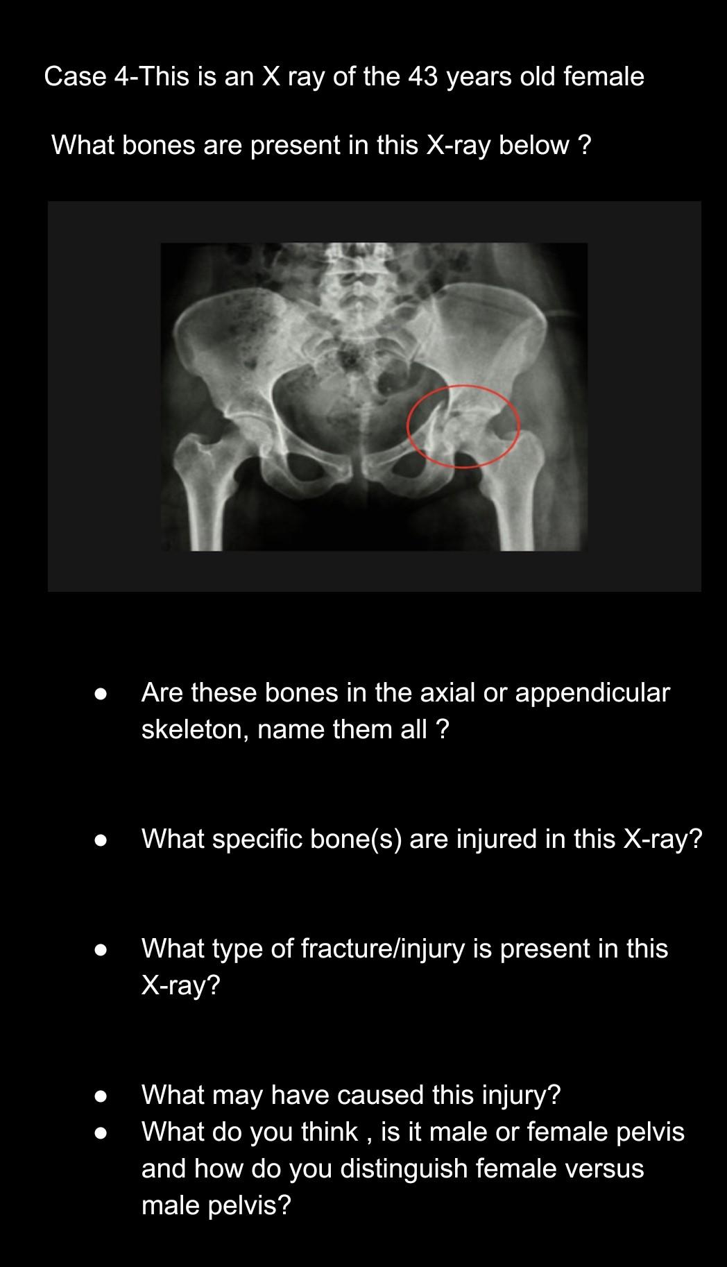 male vs female pelvis x ray