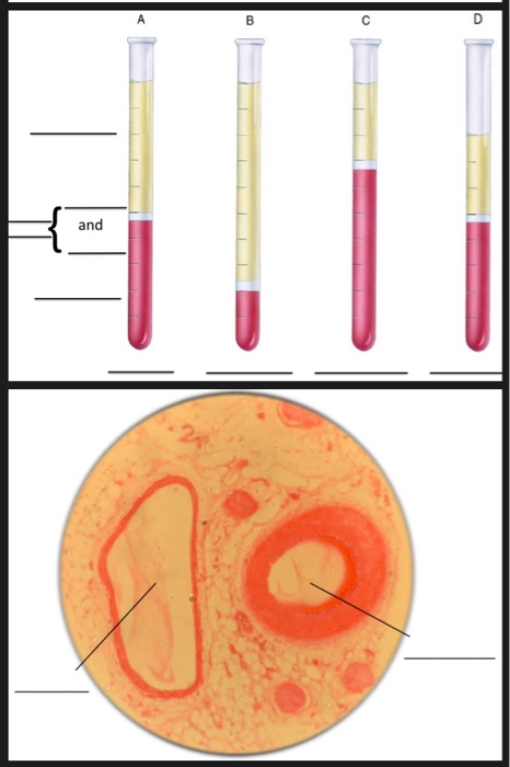 Solved B D And | Chegg.com