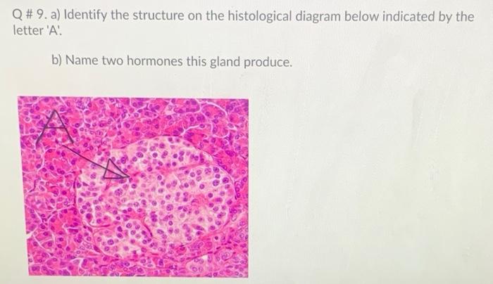 Solved Q # 9. a) Identify the structure on the histological | Chegg.com