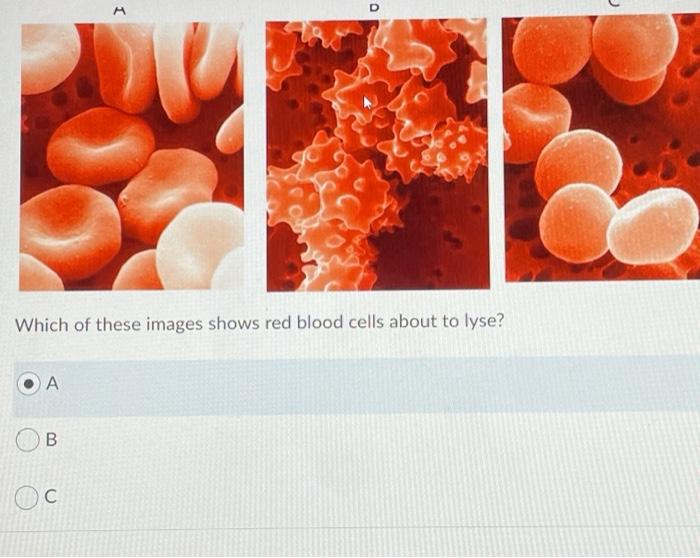 Solved M A o Which of these images shows red blood cells | Chegg.com