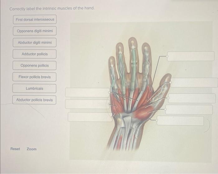 Solved Correctly label the flexors of the wrist and