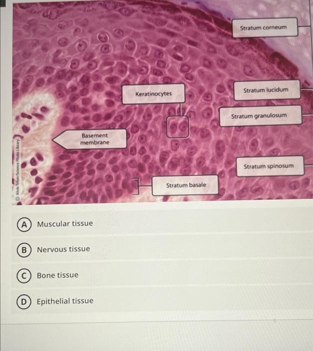 Solved Stratum corneum Keratinocytes Stratum lucidum Stratum | Chegg.com