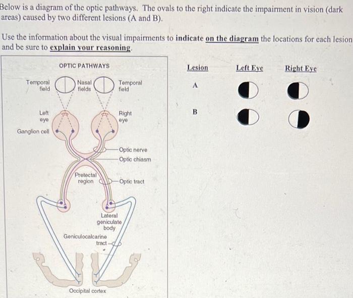 Solved Below is a diagram of the optic pathways. The ovals | Chegg.com