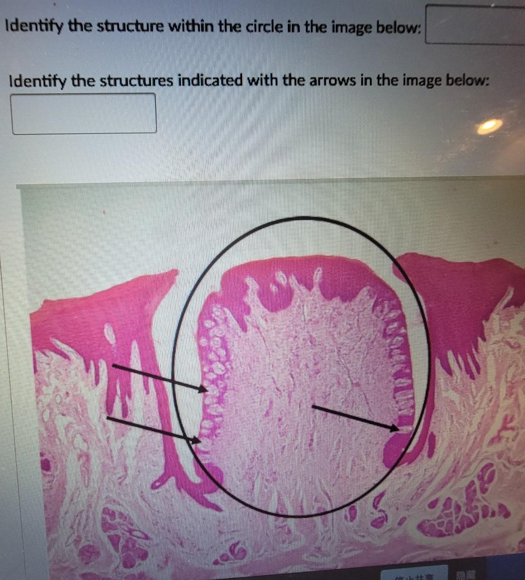 solved-dentify-the-structure-with-b-in-the-lumen-in-the-chegg