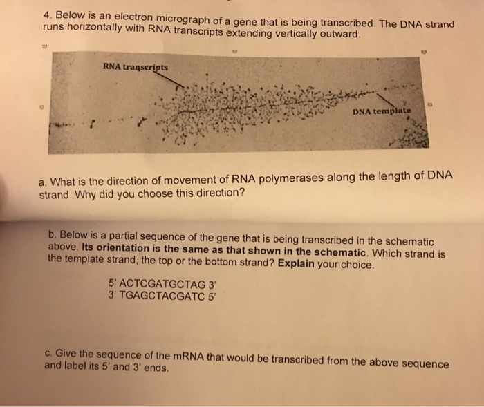 Solved 4. Below is an electron micrograph of a gene that is | Chegg.com