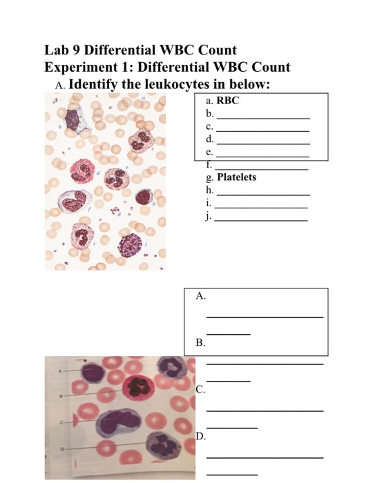 Solved Lab 9 Differential WBC Count Experiment 1