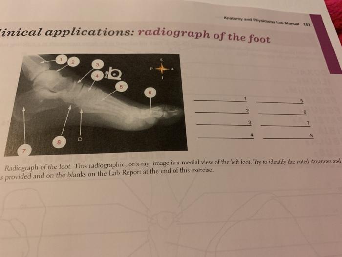 Solved Anatomy Phyo Mar 15 -inical applications: radiograph | Chegg.com