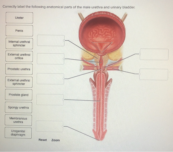 Uretrostomia perineală - Dr. Marcel Rad