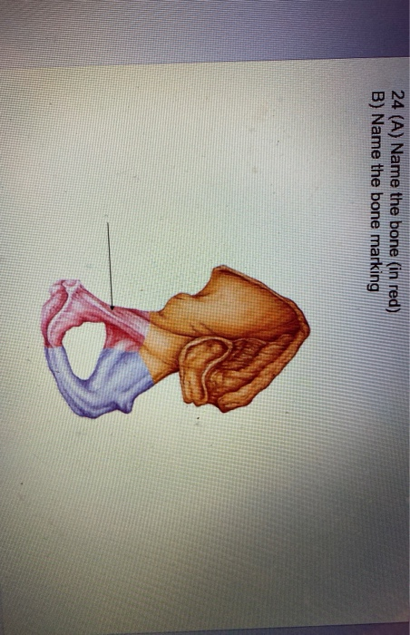 Solved 23 A) Name The Bone B) Name The Bone Marking 24 (A) | Chegg.com