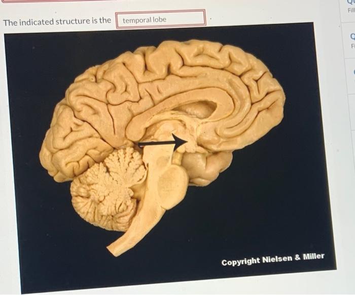 Solved The indicated structure is the temporal lobe Biology Diagrams