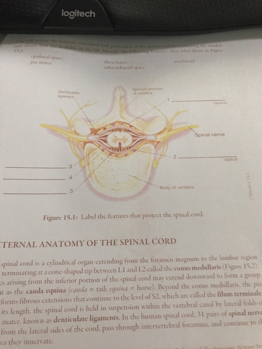 Solved logitech pidural space pia mata subarachnoid pace | Chegg.com