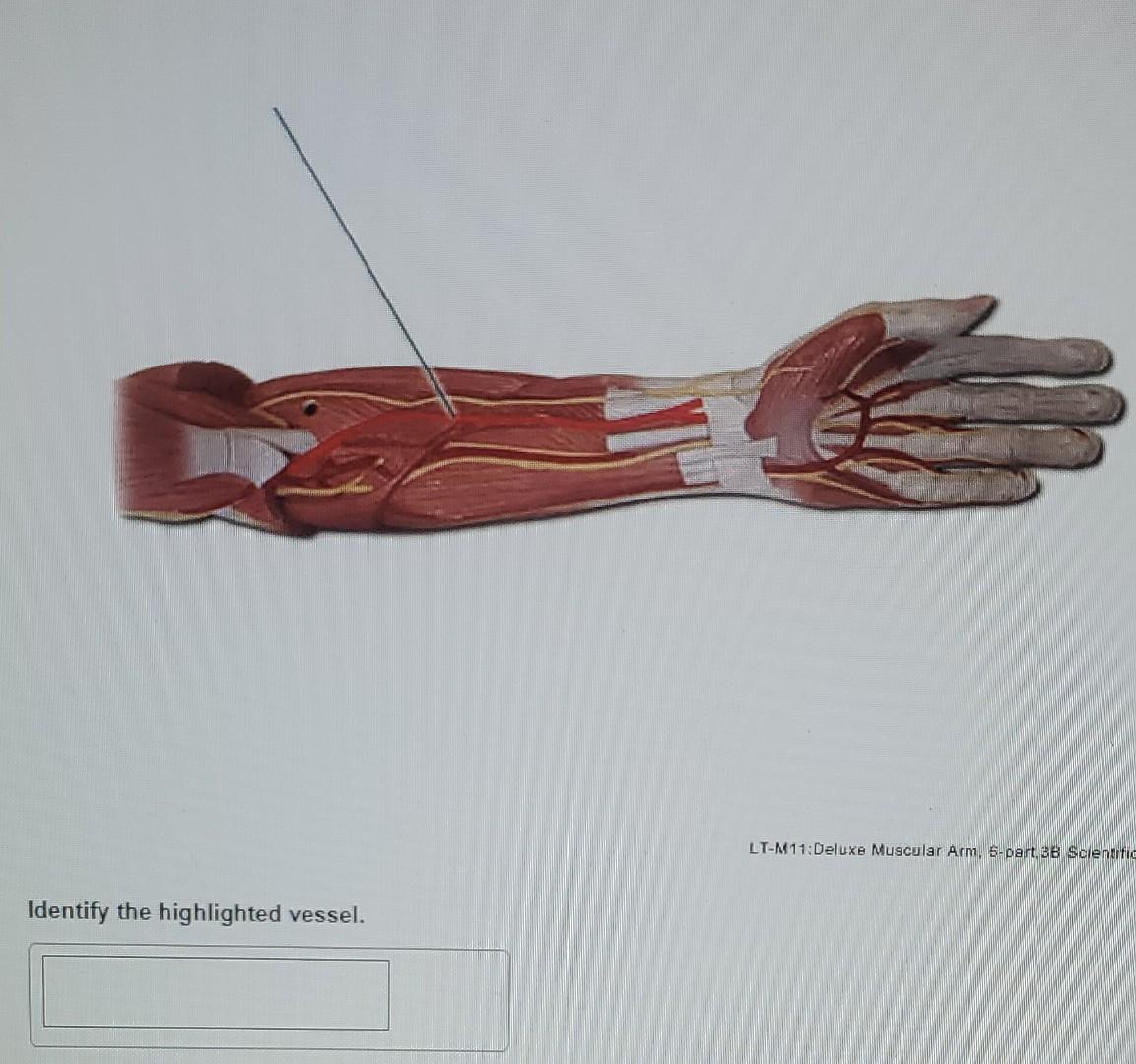 LT-M11:Deluxe Muscular Arm, E-part, 36 Sciendifio
Identify the highlighted vessel.