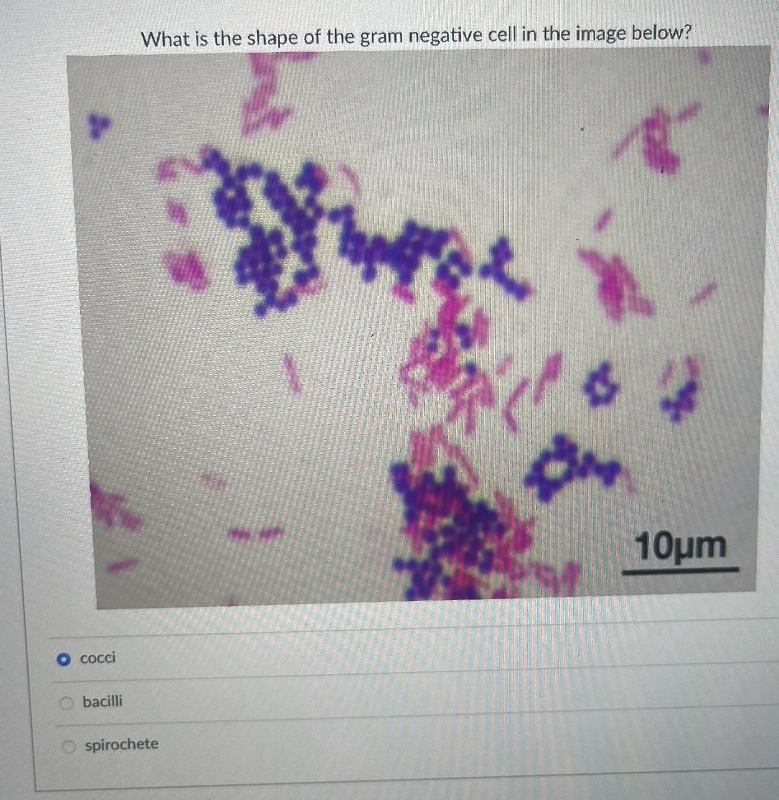 Solved What is the shape of the gram negative cell in the | Chegg.com
