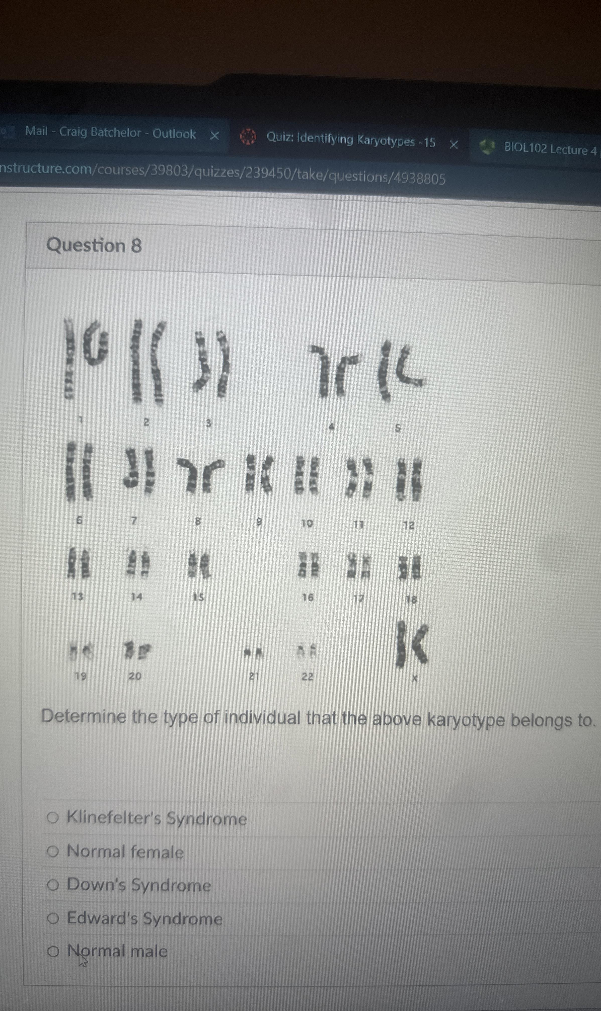 Solved MODULE 2 ﻿LAB (Karyotypes)Activity: Five karyotypes | Chegg.com