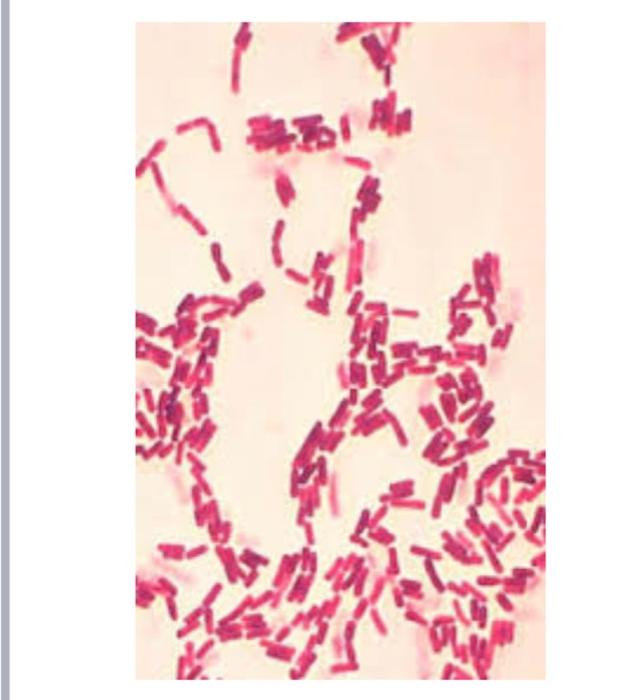 kindly help me to identify the unknown 4 organism | Chegg.com