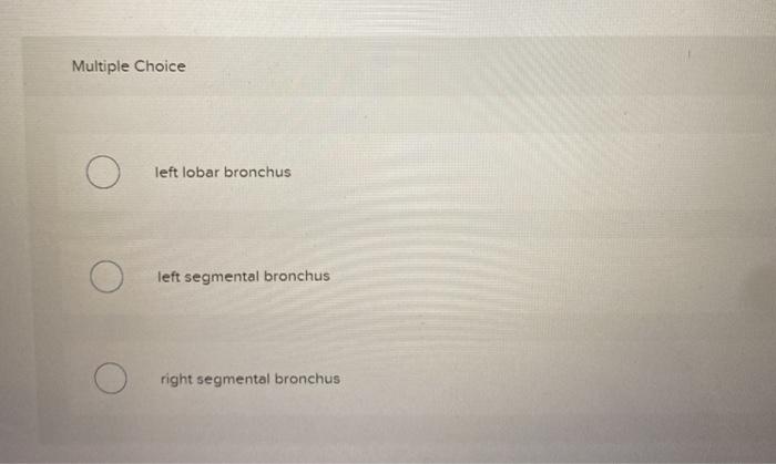 Solved Which structure is highlighted (reference leader | Chegg.com