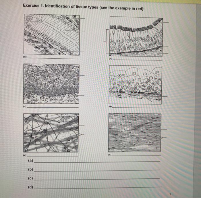 Solved Exercise 1. Identification of tissue types (see the | Chegg.com