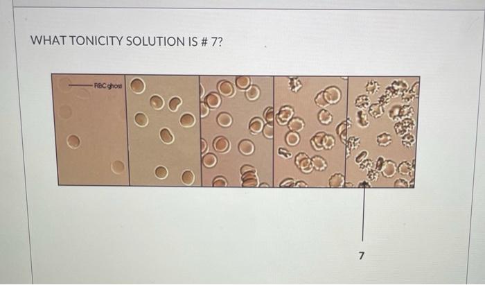 Solved WHAT TONICITY SOLUTION IS # 7? RBC Thou 7 | Chegg.com