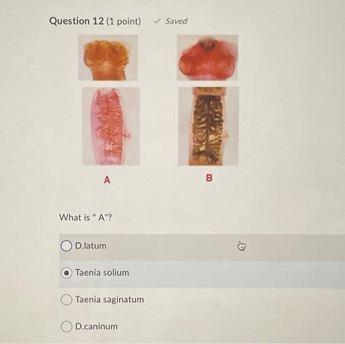 Solved Question 8 (1 point) What is microthrix? Omicrovilli | Chegg.com
