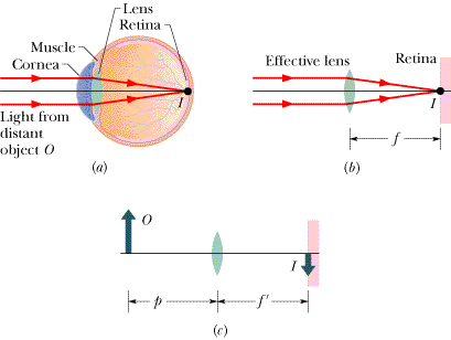 Solved Figure (a) shows the basic structure of a human eye. | Chegg.com