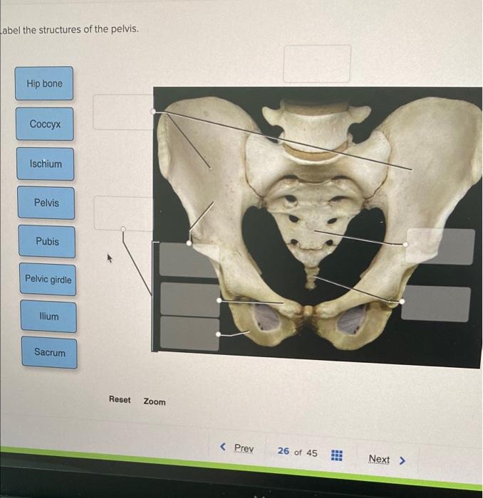 Hip bone - ilium, ischium and pubis