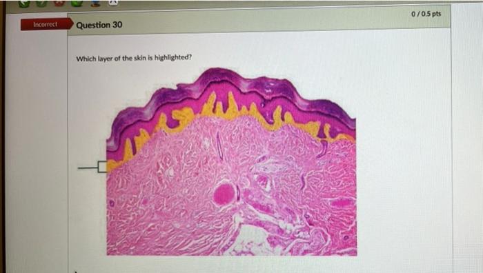 Solved Incorrect Question 30 Which layer of the skin is | Chegg.com