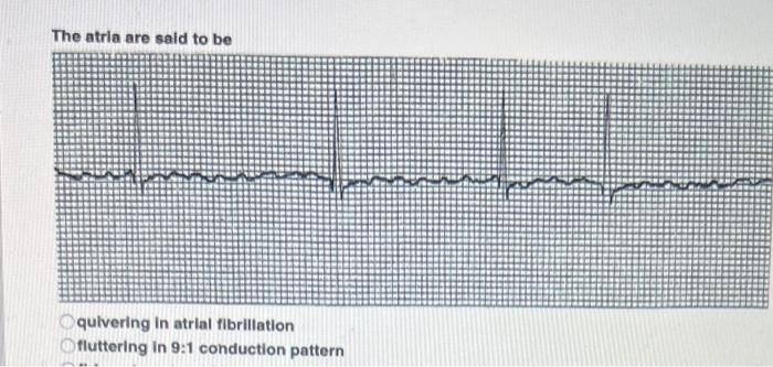 quivering in atrial fibriliation fluttering in 9:1 | Chegg.com