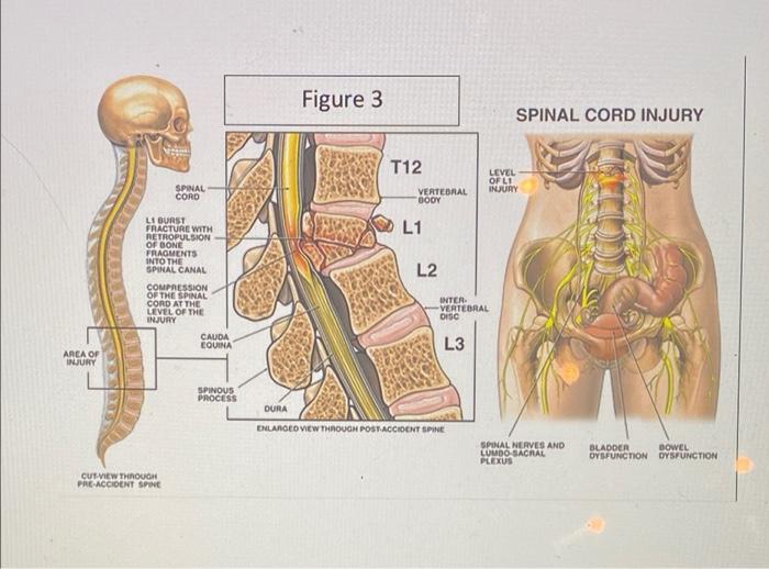 Solved 4.) Explain why the fracture shown in Figures 2 and 3 | Chegg.com