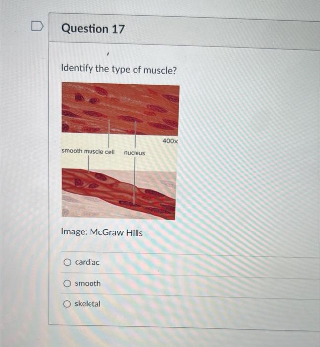Solved 1. A stroke volume is the amount of blood ejected | Chegg.com