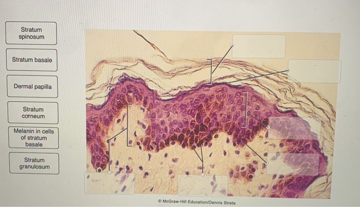 Solved Label the epidermal and dermal layers in this | Chegg.com