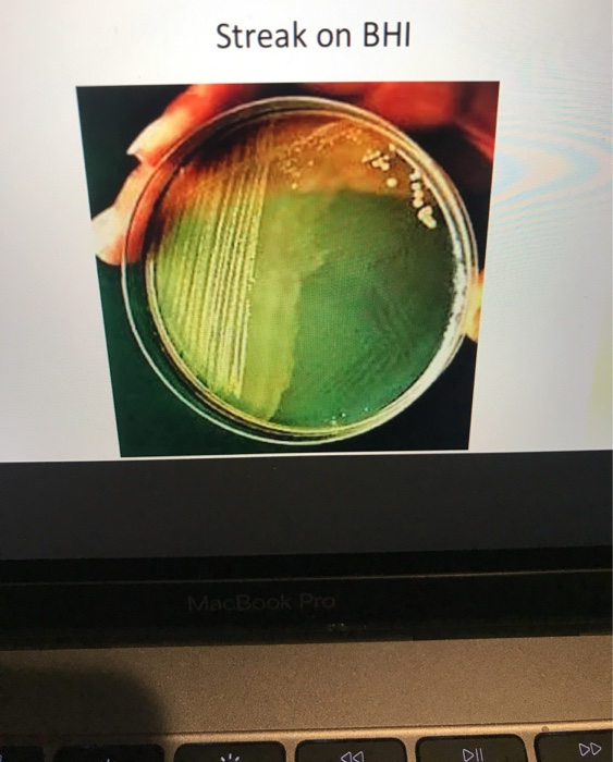 Urease Streaking Solved @ Q Search 23 Mac KIA SIM Urease Gram stain Streak on | Chegg.com
