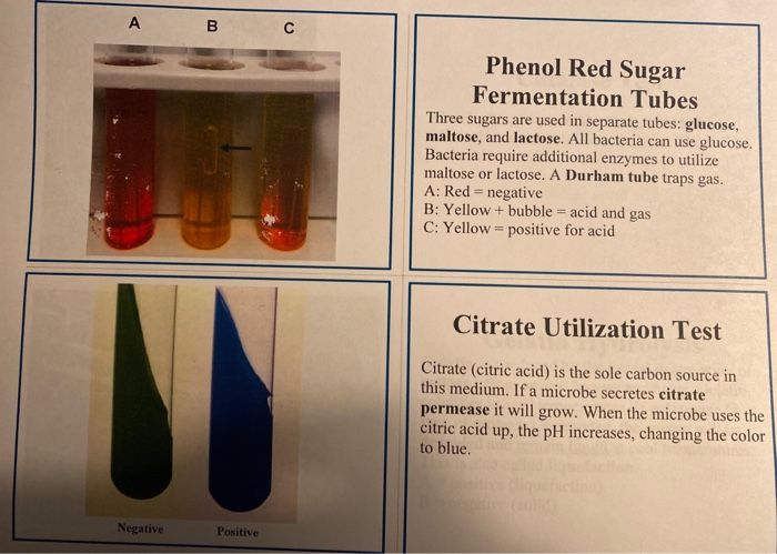 Table 15.2: IMVIC Tests Fermentation of Sugars SIM | Chegg.com