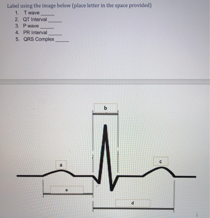 Solved Electrocardiograms An electrocardiogram is a