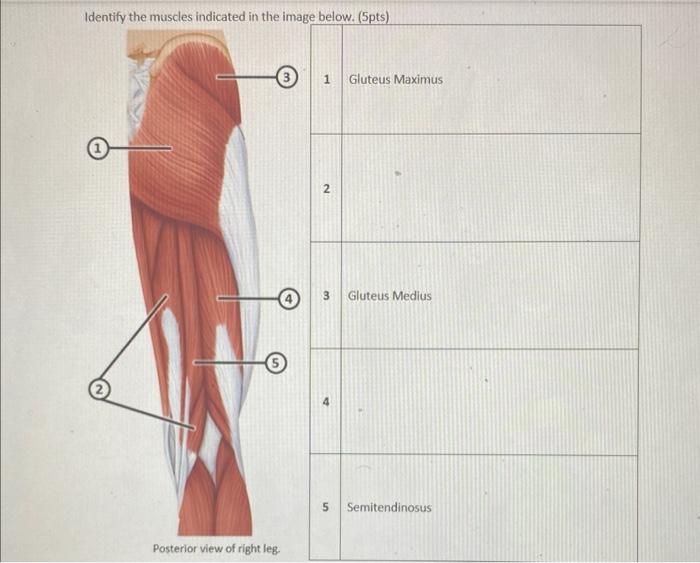 Solved Identify The Muscles Indicated In The Image Below | Chegg.com