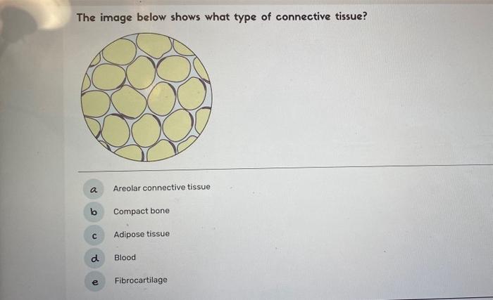 Solved The image below shows what type of connective tissue? | Chegg.com