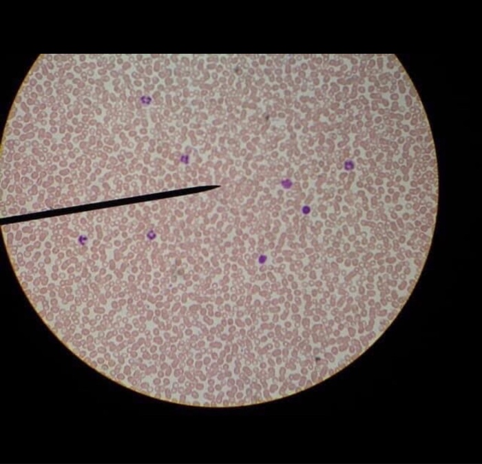 solved-15-what-is-the-approximate-diameter-of-a-red-blood-chegg