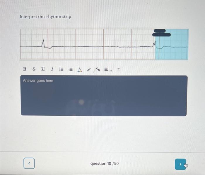 Interpret This Rhythm Strip Interpret This Rhythm | Chegg.com