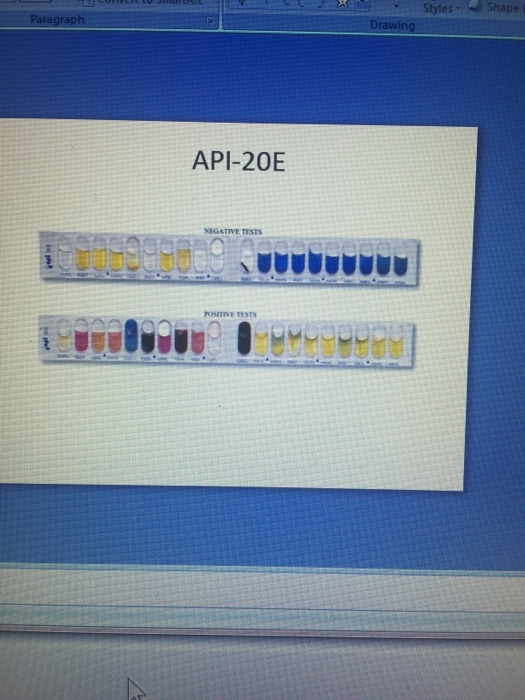 Exercise 8 Use of the API 20E System to Identify Gram | Chegg.com