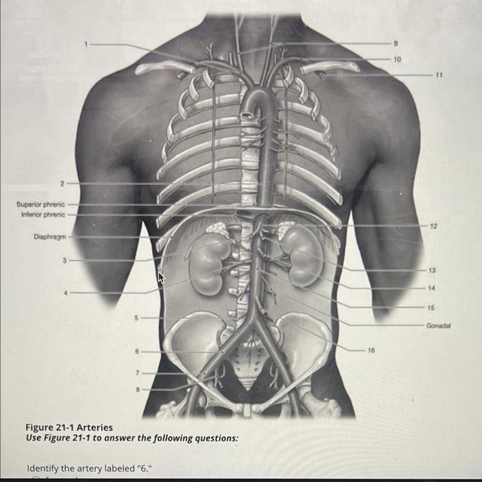 Solved Spleen A B M 0 0 D Figure 18 2 Using Figure 18 2 Chegg Com   Image