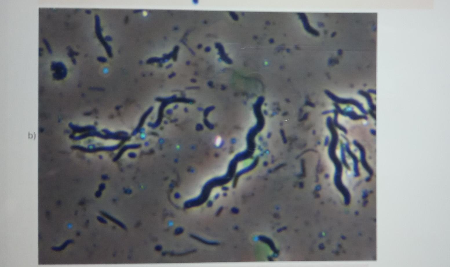 Solved Identify the shape of each of the following bacteria: | Chegg.com